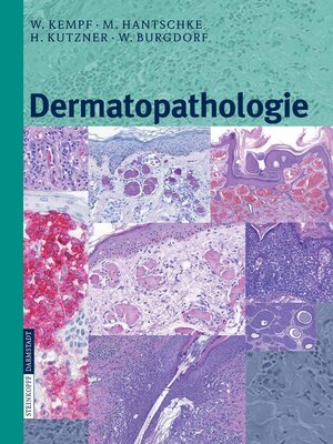 cover image of Dermatopathologie